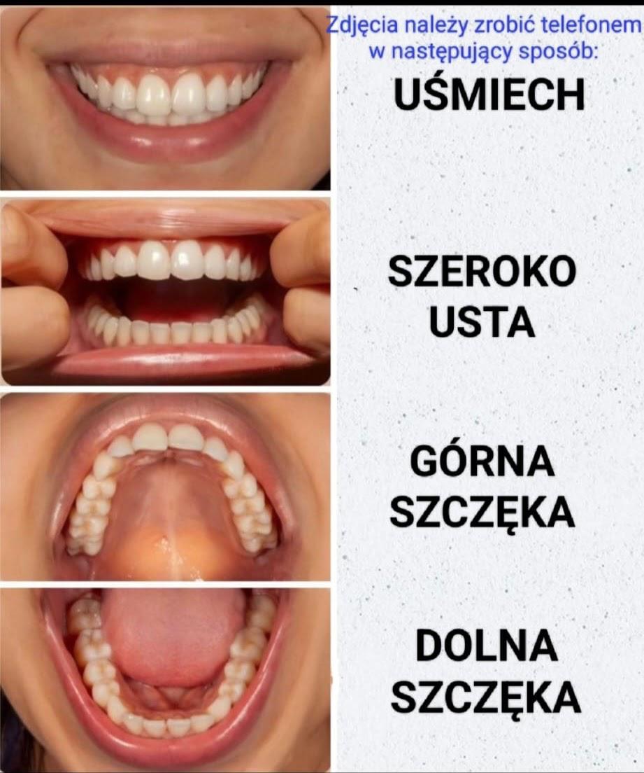 Wzór wykonania czterech zdjęć zębów telefonem